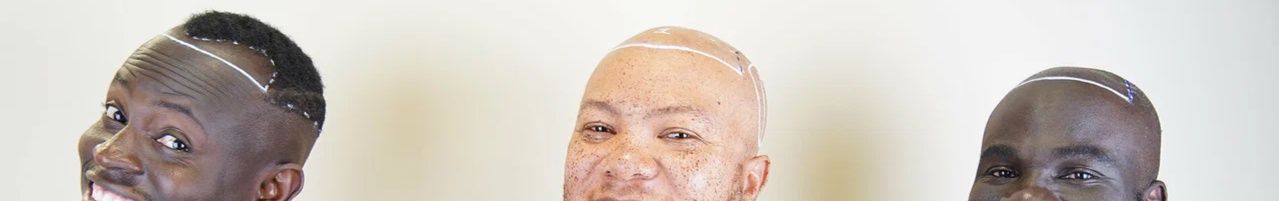 byhairclinic | Hair Transplant Center cover