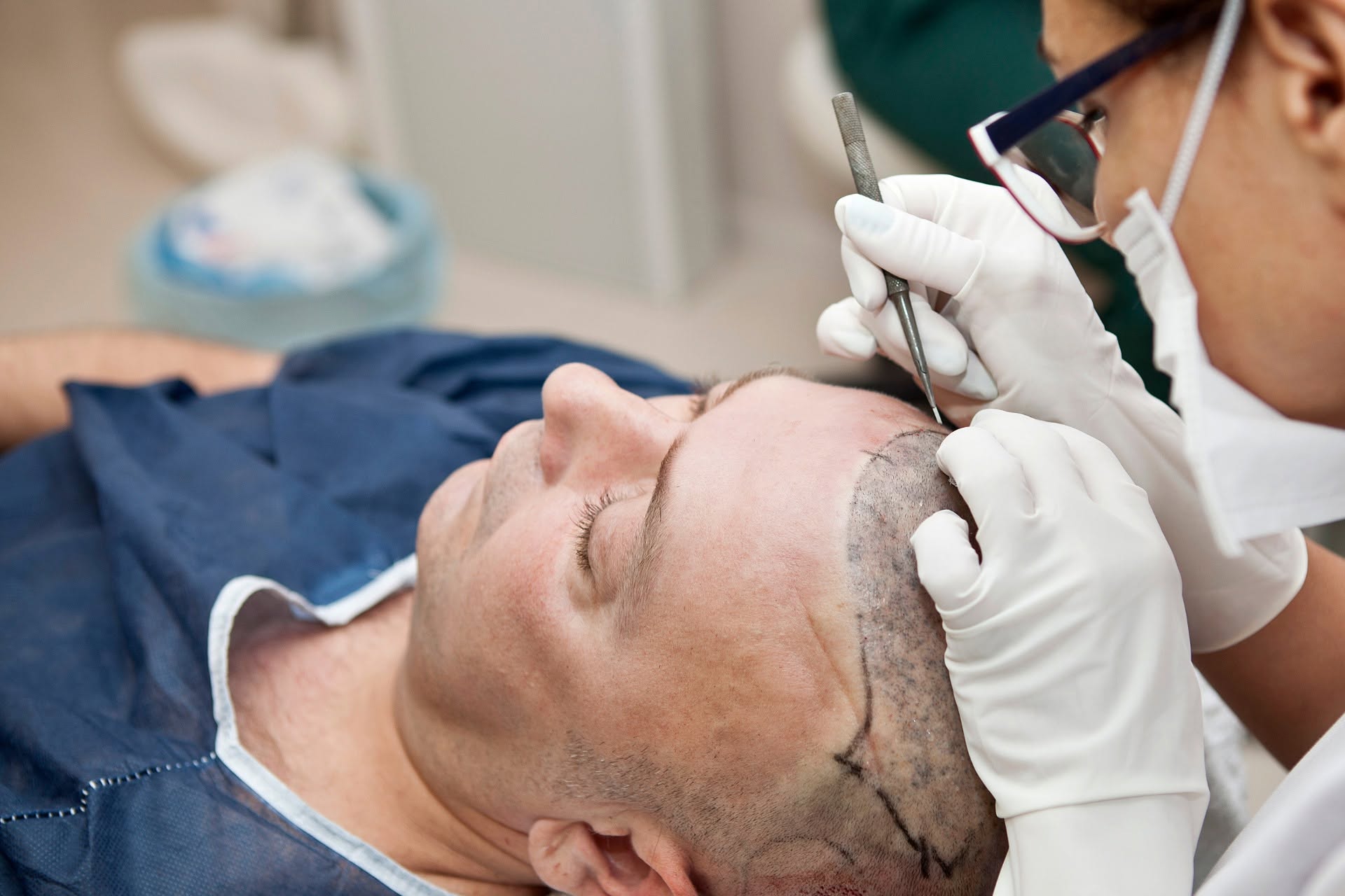 Universal Hair Transplant cover