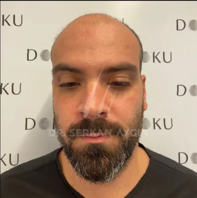 DHI - Before