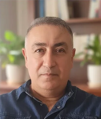 Hair Transplant - After
