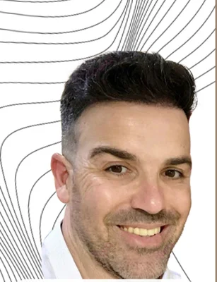 Hair Transplant - After